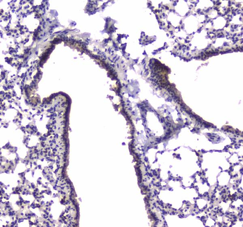 Anti-PDE4D Antibody