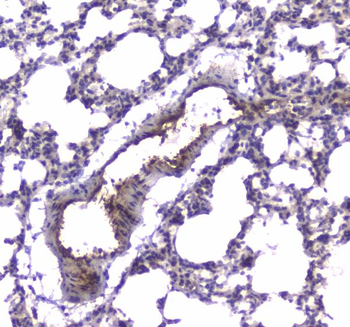 Anti-PDE4D Antibody