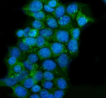 Anti-CLPP Antibody