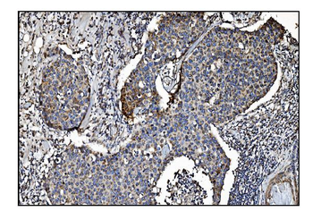 Anti-CLPP Antibody