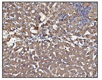 Anti-CLPP Antibody