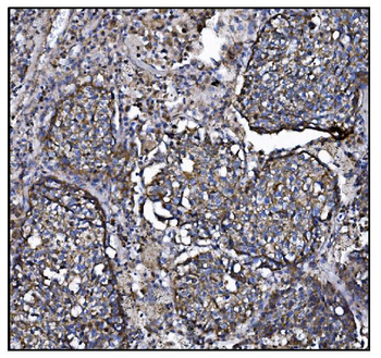 Anti-CLPP Antibody