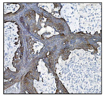 Anti-CLPP Antibody