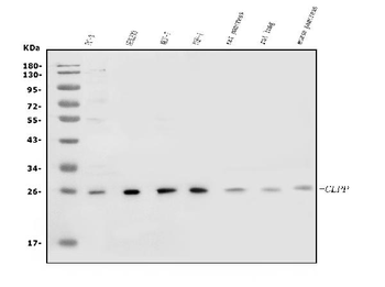 Anti-CLPP Antibody