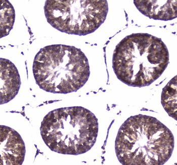 Anti-WWOX Antibody