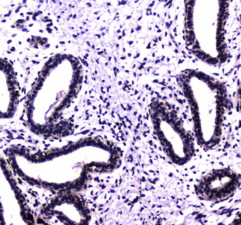 Anti-HAUSP/USP7 Antibody