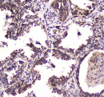 Anti-BRD7 Antibody