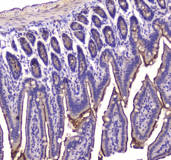 Anti-Cannabinoid Receptor I/CNR1 Antibody