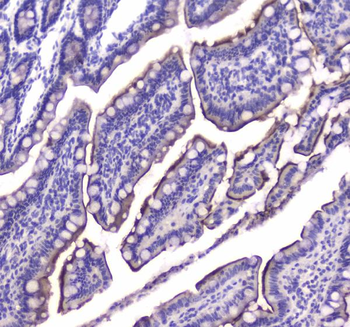 Anti-Cannabinoid Receptor I/CNR1 Antibody
