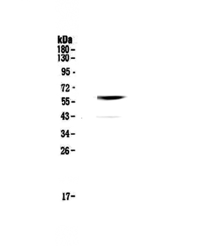 Anti-Cannabinoid Receptor I/CNR1 Antibody