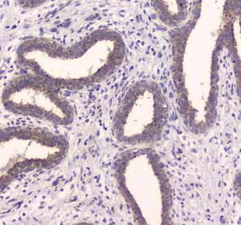 Anti-Insulin degrading enzyme/IDE Antibody