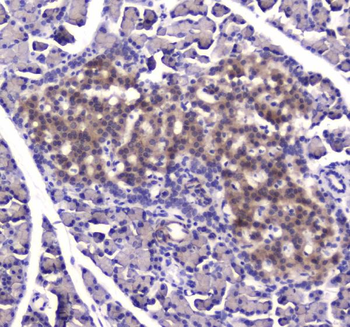 Anti-Insulin degrading enzyme/IDE Antibody