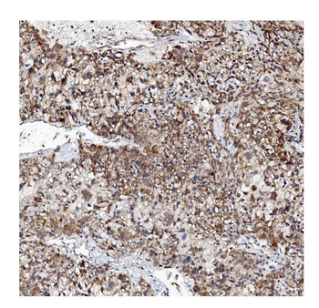 Anti-VAPB Antibody