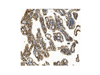 Anti-VAPB Antibody