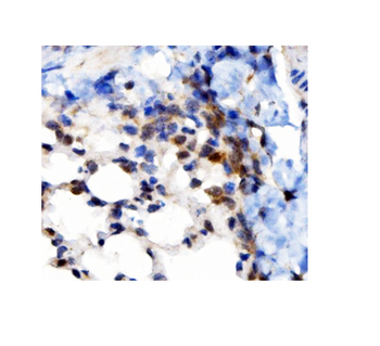 Anti-VAPB Antibody