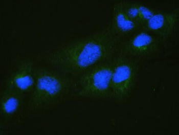 Anti-RALBP1 Antibody