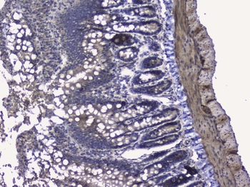 Anti-RALBP1 Antibody