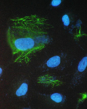 Anti-epithelial Sodium Channel alpha/SCNN1A Antibody