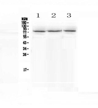 Anti-epithelial Sodium Channel alpha/SCNN1A Antibody