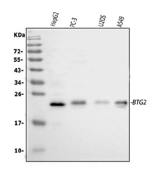 Anti-BTG2 Antibody