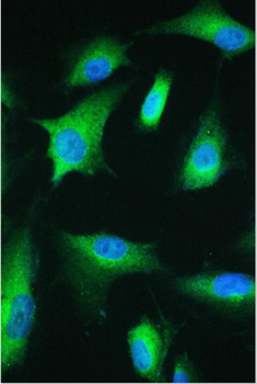 Anti-strogen Related Receptor gamma/ESRRG Antibody