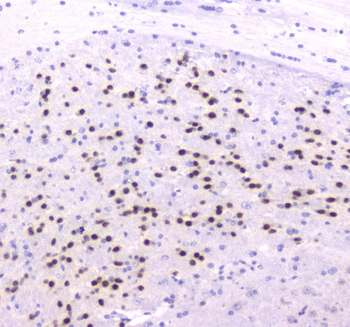 Anti-strogen Related Receptor gamma/ESRRG Antibody