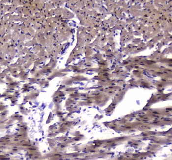 Anti-strogen Related Receptor gamma/ESRRG Antibody