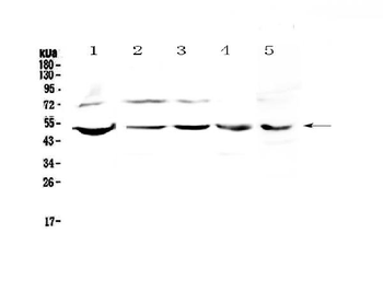 Anti-strogen Related Receptor gamma/ESRRG Antibody