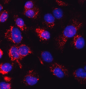 Anti-Glutathione Reductase/GSR Antibody