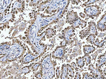 Anti-Glutathione Reductase/GSR Antibody