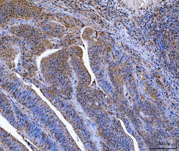 Anti-Glutathione Reductase/GSR Antibody