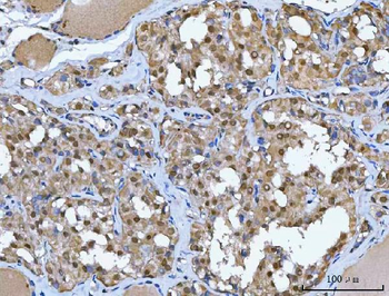 Anti-Glutathione Reductase/GSR Antibody