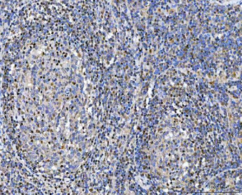 Anti-Glutathione Reductase/GSR Antibody