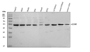 Anti-Glutathione Reductase/GSR Antibody