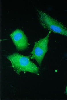 Anti-PARN Antibody