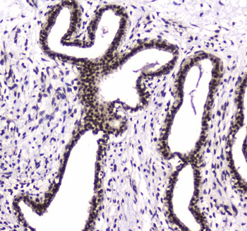Anti-PARN Antibody