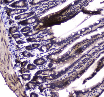 Anti-PARN Antibody