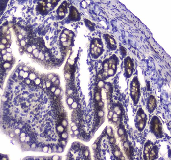 Anti-PARN Antibody