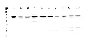 Anti-PARN Antibody