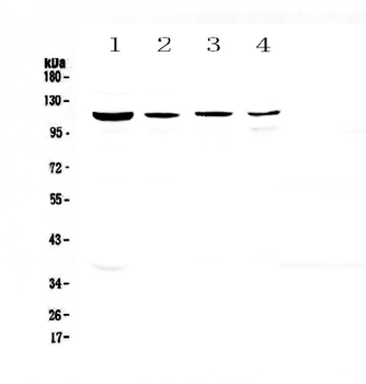 RPGR Rabbit Polyclonal Antibody