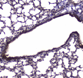 Anti-NFIB/NF1B2 Antibody