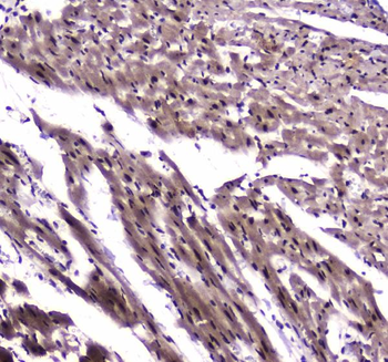 Anti-NFIB/NF1B2 Antibody
