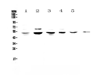 Anti-NFIB/NF1B2 Antibody