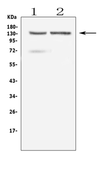 RTEL1 Rabbit Polyclonal Antibody