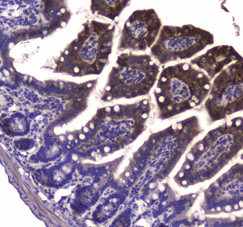 Anti-GDA Antibody