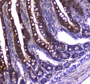 Anti-GDA Antibody