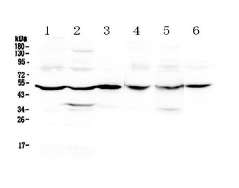 Anti-GDA Antibody