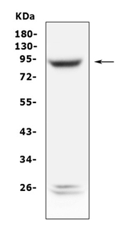 PLA2G6 Rabbit Polyclonal Antibody
