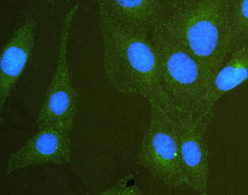 Anti-SCRIBBLE Antibody