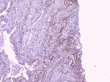 Anti-PBP/PEBP1 Antibody